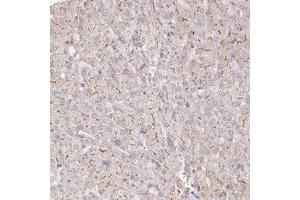 Immunohistochemical staining of human liver with TCHP polyclonal antibody  shows distinct membranous positivity in hepatocytes at 1:1000-1:2500 dilution. (TCHP Antikörper)