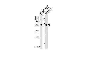 Western blot analysis of lysates from SH-SY5Y cell line and mouse brain tissue lysates (from left to right), using DK2 Antibody (M1) 7033a.