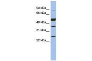 Image no. 1 for anti-Melanoma Antigen Family B, 3 (MAGEB3) (AA 35-84) antibody (ABIN6744053)