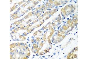 Immunohistochemistry of paraffin-embedded Human stomach using MSRB2 Polyclonal Antibody at dilution of 1:100 (40x lens). (MSRB2 Antikörper)