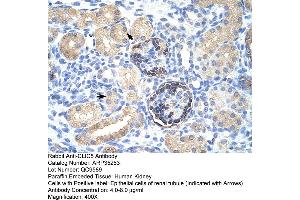 Human kidney (CLIC5 Antikörper  (C-Term))