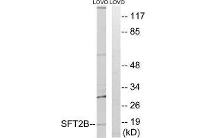 Western Blotting (WB) image for anti-Vesicle Transport Protein SFT2B (SFT2B) (Internal Region) antibody (ABIN1852378)