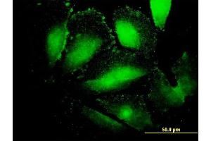 Immunofluorescence of monoclonal antibody to AFP on HepG2 cell. (alpha Fetoprotein Antikörper  (AA 500-609))