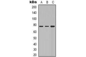 Western blot analysis of Beta-galactosidase expression in Hela (A), A549 (B), NIH3T3 (C) whole cell lysates. (GLB1 Antikörper)