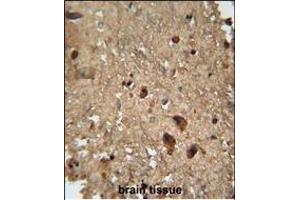 RAN antibody (Center) (ABIN652226 and ABIN2840946) immunohistochemistry analysis in formalin fixed and paraffin embedded human brain tissue followed by peroxidase conjugation of the secondary antibody and DAB staining. (RAN Antikörper  (AA 112-140))