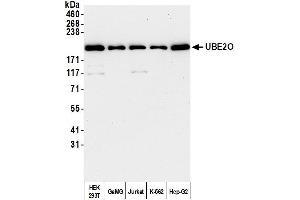 anti-Ubiquitin-Conjugating Enzyme E2O (UBE2O) (AA 725-775) antibody