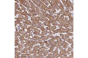 Immunohistochemical staining of human liver with LOC728597 polyclonal antibody ( Cat # PAB28327 ) shows strong cytoplasmic positivity in hepatocytes at 1:200 - 1:500 dilution. (DCDC2C Antikörper)