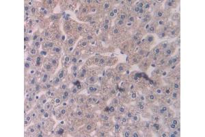 IHC-P analysis of liver tissue, with DAB staining. (RALBP1 Antikörper  (AA 192-380))