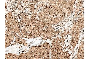 Immunohistochemistry analysis using Rabbit Anti-FUNDC1 Polyclonal Antibody (ABIN5066123). (FUNDC1 Antikörper  (N-Term) (Atto 594))