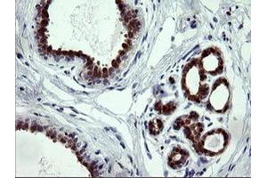 Image no. 2 for anti-Cytidine Monophosphate (UMP-CMP) Kinase 1, Cytosolic (CMPK1) antibody (ABIN1497544) (Cytidine Monophosphate (UMP-CMP) Kinase 1, Cytosolic (CMPK1) Antikörper)