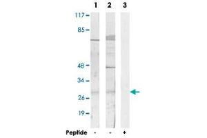 Western blot analysis of extracts from HUVEC cells (Lane 1 and lane 3) and COLO 205 cells (Lane 2), using SIX6 polyclonal antibody .
