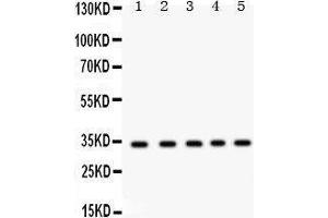 Western Blotting (WB) image for anti-Estrogen Receptor Binding Site Associated, Antigen, 9 (EBAG9) (AA 31-213) antibody (ABIN3043569) (RCAS1 Antikörper  (AA 31-213))