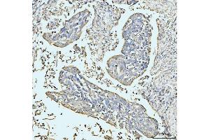 IHC analysis of GRPEL1 using anti-GRPEL1 antibody (ABIN7602643).