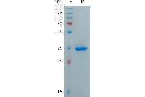 SDS-PAGE (SDS) image for Chemokine (C-X-C Motif) Ligand 5 (CXCL5) protein (Fc Tag) (ABIN7491503)