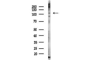 anti-Endoplasmic Reticulum To Nucleus Signaling 1 (ERN1) (pSer724) antibody