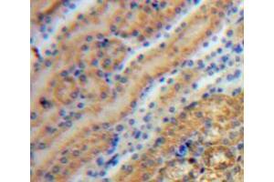 IHC-P analysis of kidney tissue, with DAB staining. (Tyrosine Hydroxylase Antikörper  (AA 34-301))