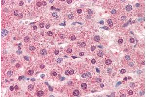 Human Liver (formalin-fixed, paraffin-embedded) stained with CTSL1 antibody ABIN364356 at 5 ug/ml followed by biotinylated anti-mouse IgG secondary antibody ABIN481714, alkaline phosphatase-streptavidin and chromogen. (Cathepsin L Antikörper  (AA 114-333))