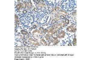 Immunohistochemistry (IHC) image for anti-Solute Carrier Family 38 Member 4 (SLC38A4) (Middle Region) antibody (ABIN310355) (SLC38A4 Antikörper  (Middle Region))