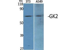Western Blot (WB) analysis of specific cells using GK2 Polyclonal Antibody. (GK2 Antikörper  (Internal Region))