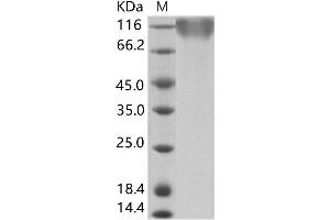 Western Blotting (WB) image for Epstein-Barr Virus Membrane Antigen gp350 (EBV gp350) protein (His tag) (ABIN7198937)