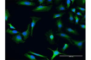Immunofluorescence of purified MaxPab antibody to CHD9 on HeLa cell. (CHD9 Antikörper  (AA 1-119))
