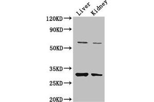 Western Blot Positive WB detected in: Mouse liver tissue, Mouse kidney tissue All lanes: PANK2 antibody at 3. (PANK2 Antikörper  (AA 437-490))