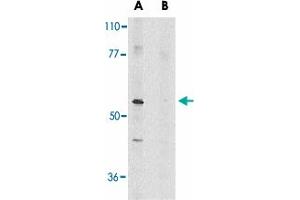 Western blot analysis of Ripk3 in mouse NIH/3T3 whole cell lysate in the absence (A) or presence (B) of blocking peptide with Ripk3 polyclonal antibody  at 1 ug/mL . (RIPK3 Antikörper  (AA 473-486))