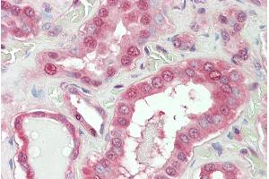 ABIN768583 (5µg/ml) staining of paraffin embedded Human Kidney. (NOX1 Antikörper  (Internal Region))