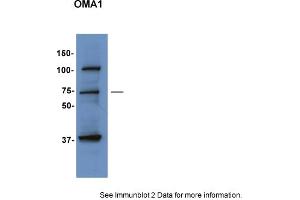 Sample Type: HepG2 cellsPrimary Dilution: 1:1000Secondary Antibody: anti-Rabbit TBST with 5% BSASecondary Dilution: 1:5000Image Submitted by: Hana SabicUniversity of Utah (OMA1 Antikörper  (Middle Region))