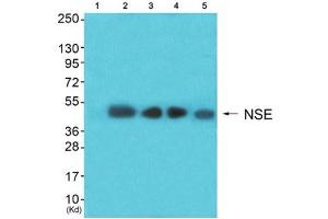 Western Blotting (WB) image for anti-Enolase 2 (Gamma, Neuronal) (ENO2) (C-Term) antibody (ABIN1848702) (ENO2/NSE Antikörper  (C-Term))