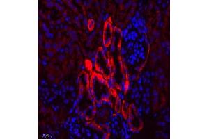 Immunofluorescence of paraffin embedded mouse kidney using SLC7A8 (ABIN7074503) at dilution of 1:300 (400x lens) (LAT2 Antikörper)