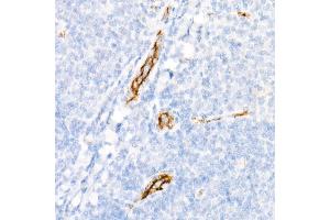 Immunohistochemistry of paraffin-embedded Human tonsil using von Willebrand factor (VWF) antibody (ABIN7271339) at dilution of 1:800 (40x lens). (VWF Antikörper)