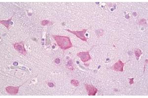Anti-CSNK1E antibody IHC staining of human brain, cortex neurons. (CK1 epsilon Antikörper  (AA 276-325))