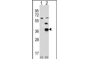 Western blot analysis of PDXK (arrow) using rabbit polyclonal PDXK Antibody (H13) (ABIN391110 and ABIN2841241).
