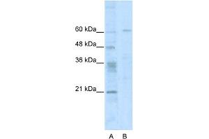 WB Suggested Anti-ZNF192 Antibody Titration:  0. (ZNF192 Antikörper  (N-Term))