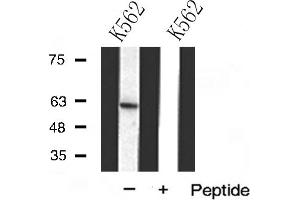 Western blot analysis of DCT(TRP2) expression in K562 cells (DCT Antikörper  (N-Term))