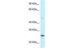 Image no. 1 for anti-Heterogeneous Nuclear Ribonucleoprotein F (HNRNPF) (AA 328-377) antibody (ABIN6747978) (HNRNPF Antikörper  (AA 328-377))