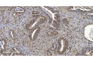 IHC analysis of HP1 alpha/CBX5 using anti-HP1 alpha/CBX5 antibody (ABIN7599057). (CBX5 Antikörper  (AA 1-191))