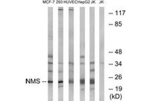 Western Blotting (WB) image for anti-Neuromedin S (NMS) (AA 104-153) antibody (ABIN2890459) (NMS Antikörper  (AA 104-153))