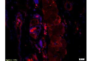 Immunofluorescence (IF) image for anti-Hepatitis B Virus Surface Antigen (HBsAg) antibody (ABIN723066) (HBSAg Antikörper)