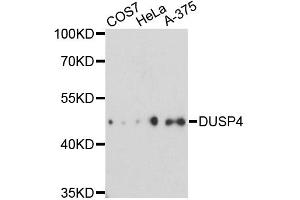 Western blot analysis of extracts of various cell lines, using DUSP4 antibody. (DUSP4 Antikörper)