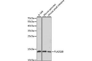 Western blot analysis of extracts of various cell lines, using PLG1B antibody (ABIN6129428, ABIN6145724, ABIN6145725 and ABIN6221143) at 1:1000 dilution. (PLA2G1B Antikörper  (AA 23-148))