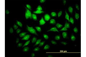 Immunofluorescence of monoclonal antibody to PYCRL on HeLa cell. (PYCRL Antikörper  (AA 32-131))
