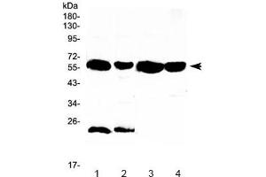 Western blot testing of 1) rat liver, 2) rat kidney, 3) mouse liver and 4) mouse kidney lysate with UGT1A1 antibody at 0. (UGT1A1 Antikörper)