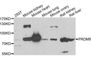 Western blot analysis of extracts of various cell lines, using PRDM5 antibody (ABIN5975510) at 1/1000 dilution. (PRDM5 Antikörper)