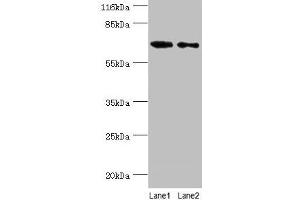 Western blot All lanes: GALNT14 antibody at 2 μg/mL Lane 1: Rat gonad tissue Lane 2: Mouse kidney tissue Secondary Goat polyclonal to rabbit IgG at 1/10000 dilution Predicted band size: 65, 61, 62 kDa Observed band size: 65 kDa (GALNT14 Antikörper  (AA 1-552))
