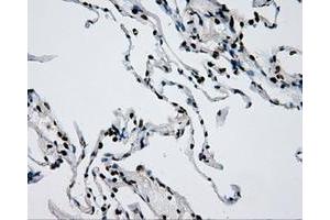 Image no. 15 for anti-Replication Protein A2, 32kDa (RPA2) antibody (ABIN1500733)