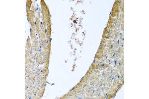 Immunohistochemistry of paraffin-embedded mouse heart using COX5B antibody at dilution of 1:100 (x40 lens). (COX5B Antikörper)