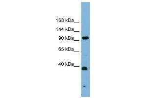 ERCC4 antibody used at 1 ug/ml to detect target protein. (ERCC4 Antikörper  (Middle Region))