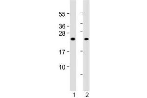 Western blot testing of 1) human skeletal muscle and 2) rat skeletal muscle lysate with MYL1 antibody at 1:2000.